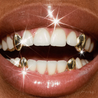 Gold Canines