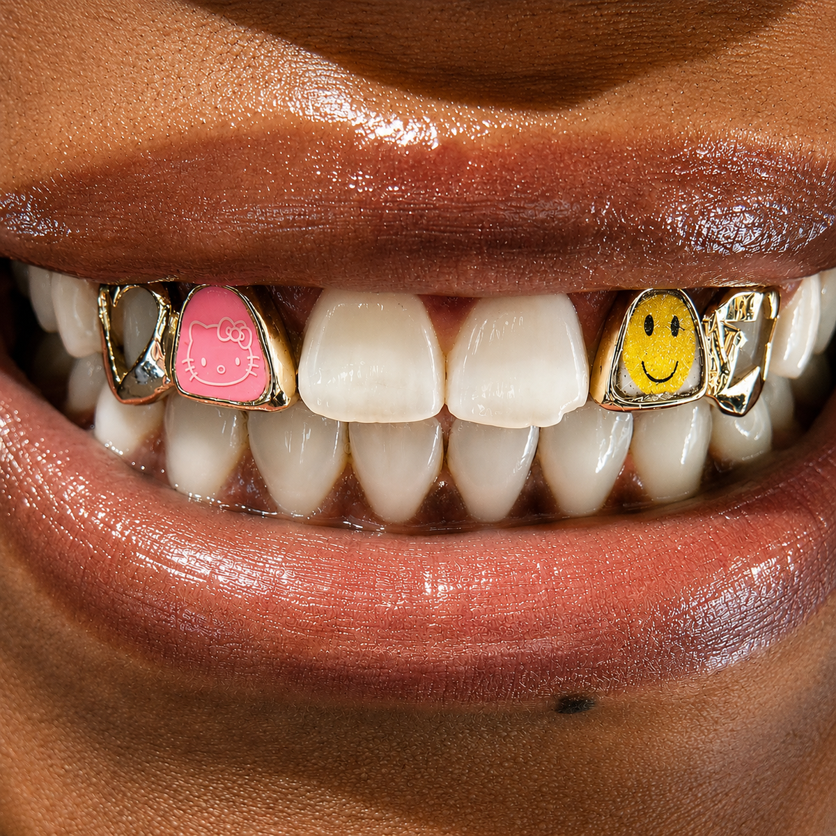 Hello Kitty & Smiley Face Custom Open-Face Grillz